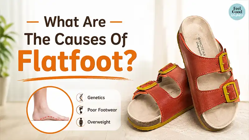 Causes Of Flatfoot